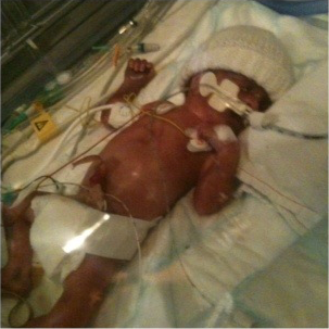 I now know NICU